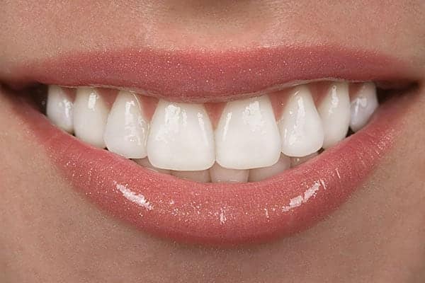 Healthy gum with no gum disease