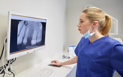 Dentist in Bendigo examing tooth x ray