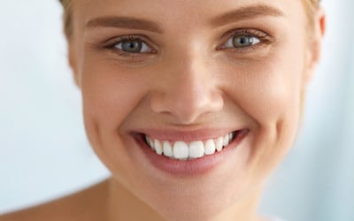 Happy female lady showing her tooth veneer